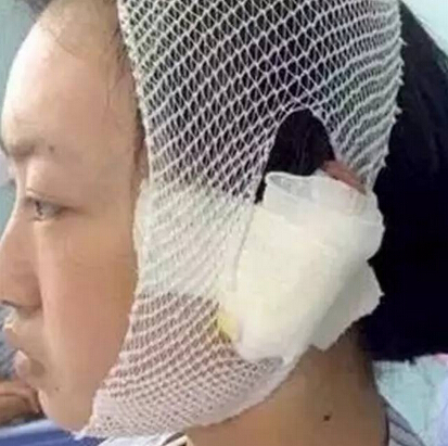 狗主因自家小狗被路人罵而狠心咬掉對方耳朵