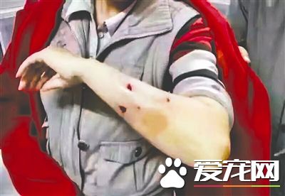 “黃色土狗”疑似咬傷22人 同時也咬了貓跟狗