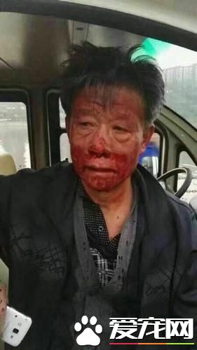 受傷老人