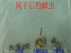 一例蜱蟲叮咬的病例分析