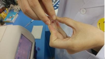 血涂片的制作及應用