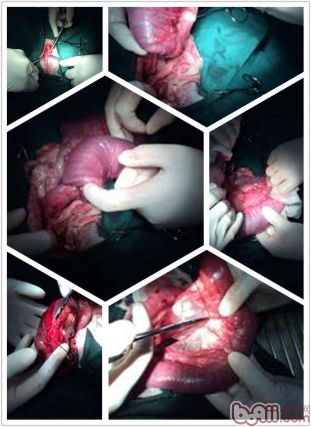 一例德牧腸套疊的診斷與治療過程