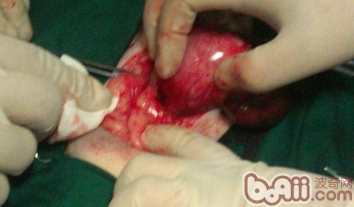 犬貓子宮蒂蓄膿癥與病例分享