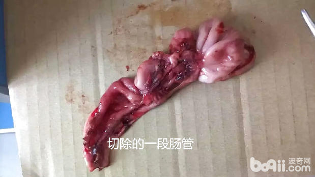 一例泰迪腸套疊的病例分析