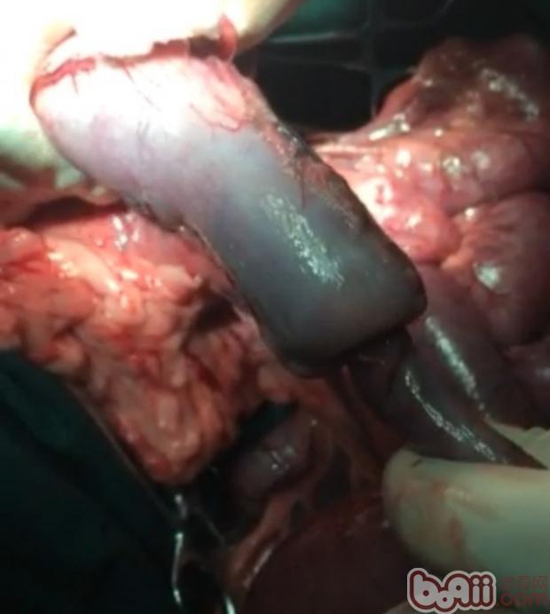 一例德牧腸套疊的診斷與治療過程