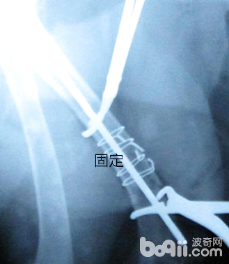 犬的肱骨骨折以及內固定