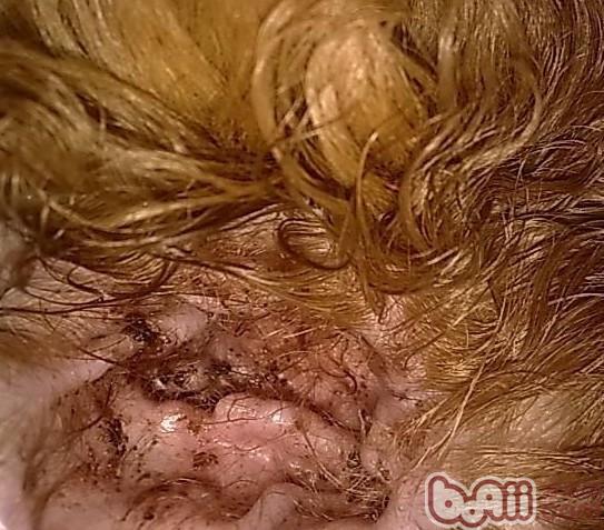 如何治療狗狗的耳螨