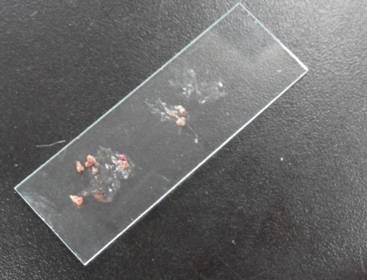 皮膚病常見檢查方法