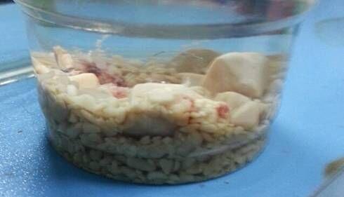 一例犬尿石癥的治療及體會