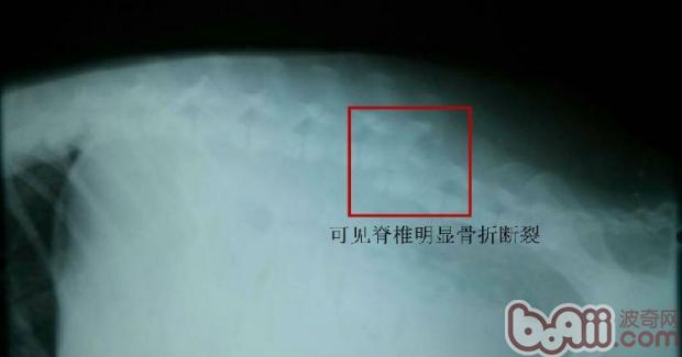 犬車禍后脊椎骨折的治療