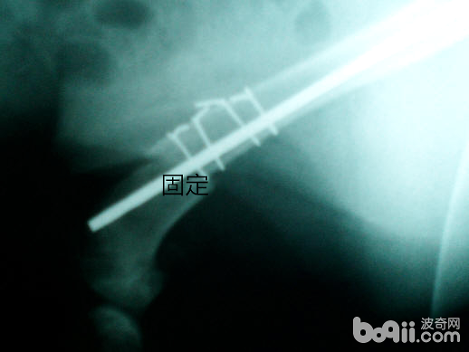 犬的肱骨骨折以及內固定