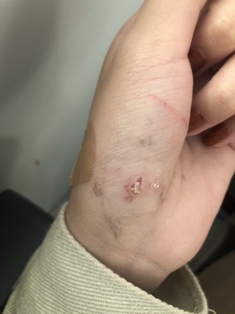 貓咪打架掛彩了怎么辦 好心疼 這5步驟送醫院前先照做