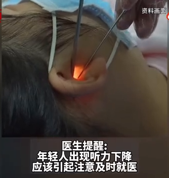 14歲女生長期戴耳機致噪音性耳聾